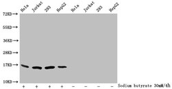 Butyryl-Histone H3 (Lys79) Polyclonal Antibody:Antibodies, Polyclonal