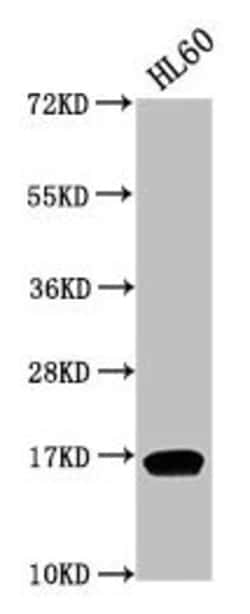Invitrogen H3K9me2 Polyclonal Antibody 100 &mu;L | Buy Online | Invitrogen&trade; | Fisher Scientific