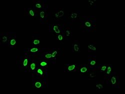 Invitrogen H3K36me2 Polyclonal Antibody 100 &mu;L; Unconjugated:Antibodies,