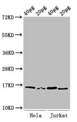 Invitrogen H3K36me2 Polyclonal Antibody 100 &mu;L; Unconjugated:Antibodies,