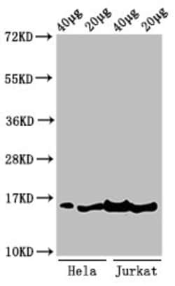 Invitrogen H3K36me3 Polyclonal Antibody 100 μL; Unconjugated:Antibodies,