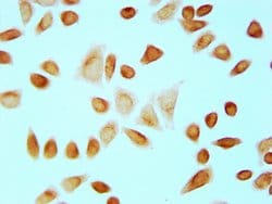 Invitrogen Formyl-Histone H4 (Lys12) Polyclonal Antibody 100 &mu;L; Unconjugated:Antikörper