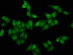 Invitrogen H4K16cr Polyclonal Antibody 100 μL; Unconjugated:Antibodies,