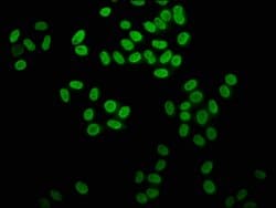 Invitrogen 2-hydroxyisobutyryl-Histone H4 (Lys31) Polyclonal Antibody 100
