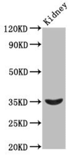 Invitrogen HOXA4 Polyclonal Antibody 100 &mu;g; Unconjugated:Antibodies,