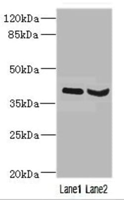 Invitrogen HOXD10 Polyclonal Antibody 100 &mu;L; Unconjugated:Antibodies,