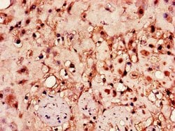 Invitrogen HPSE Polyclonal Antibody 100 &mu;g; Unconjugated:Antibodies,