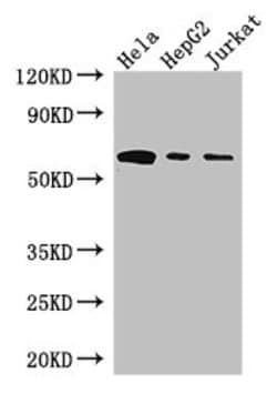 Invitrogen HPSE Polyclonal Antibody 100 &mu;g; Unconjugated:Antibodies,