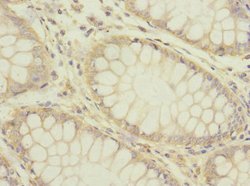 HTR3B Polyclonal Antibody 100 &mu;L | Buy Online | Thermo Scientific | Fisher Scientific