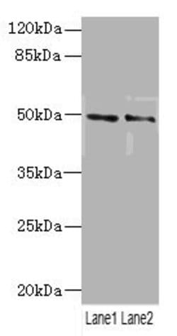 HTR3B Polyclonal Antibody 100 &mu;L | Buy Online | Thermo Scientific | Fisher Scientific