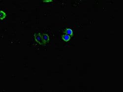 Invitrogen INVS Polyclonal Antibody 100 &mu;g | Buy Online | Invitrogen&trade; | Fisher Scientific