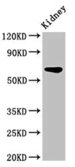 Invitrogen IPP Polyclonal Antibody 100 &mu;g; Unconjugated:Antibodies,