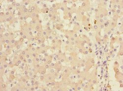 Invitrogen KHK Polyclonal Antibody 100 μL; Unconjugated:Antibodies,