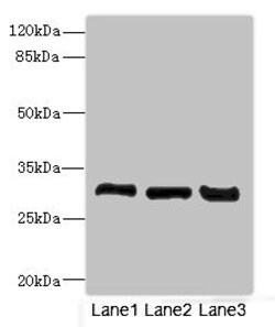 Invitrogen KHK Polyclonal Antibody 100 μL; Unconjugated:Antibodies,