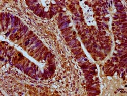 Invitrogen SRRM4 Polyclonal Antibody 100 &mu;g | Buy Online | Invitrogen&trade; | Fisher Scientific