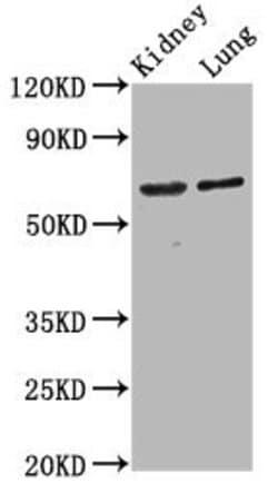 Invitrogen SRRM4 Polyclonal Antibody 100 &mu;g | Buy Online | Invitrogen&trade; | Fisher Scientific