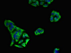 KIR3DL1 Polyclonal Antibody:Antibodies, Polyclonal