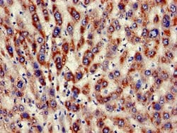 KIR3DL1 Polyclonal Antibody:Antibodies, Polyclonal