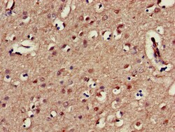 KIR3DL1 Polyclonal Antibody:Antibodies, Polyclonal