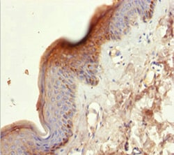 Invitrogen Cytokeratin 6A Polyclonal Antibody 100 &mu;L; Unconjugated:Antibodies,