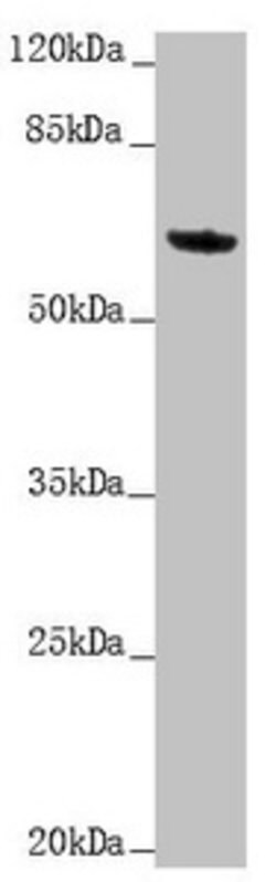 Invitrogen Cytokeratin 6A Polyclonal Antibody 100 &mu;L; Unconjugated:Antibodies,