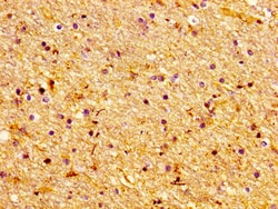 Invitrogen Lass1 Polyclonal Antibody 100 &mu;g; Unconjugated:Antibodies,