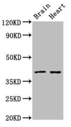 Invitrogen Lass1 Polyclonal Antibody 100 &mu;g; Unconjugated:Antibodies,