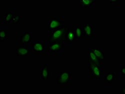 Invitrogen LHX2 Polyclonal Antibody 100 μg; Unconjugated:Antibodies,