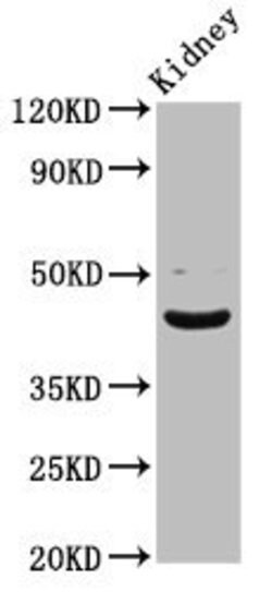 Invitrogen LHX2 Polyclonal Antibody 100 μg; Unconjugated:Antibodies,