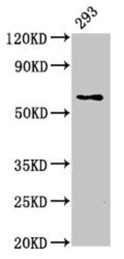 Invitrogen LPCAT2 Polyclonal Antibody 100 &mu;g; Unconjugated:Antibodies,