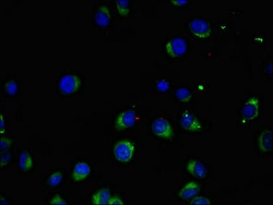 Invitrogen MAK Polyclonal Antibody 100 &mu;g; Unconjugated:Antibodies,