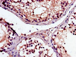 Invitrogen MAK Polyclonal Antibody 100 &mu;g; Unconjugated:Antibodies,