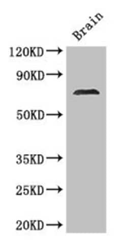 Invitrogen MAK Polyclonal Antibody 100 &mu;g; Unconjugated:Antibodies,