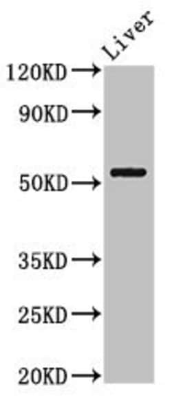 Invitrogen MEIS2 Polyclonal Antibody 100 &mu;g; Unconjugated:Antibodies,