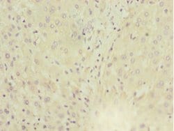 Invitrogen MGAT1 Polyclonal Antibody 100 &mu;L; Unconjugated:Antibodies,