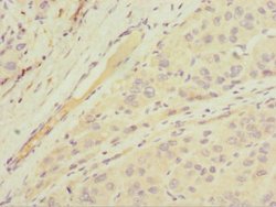 Invitrogen MGAT1 Polyclonal Antibody 100 &mu;L; Unconjugated:Antibodies,