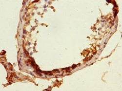 MLF1 Polyclonal Antibody:Antibodies, Polyclonal