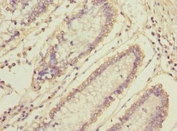 MLF1 Polyclonal Antibody:Antibodies, Polyclonal