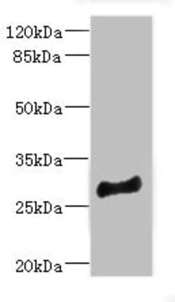 MLF1 Polyclonal Antibody:Antibodies, Polyclonal