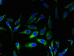 Invitrogen MPV17 Polyclonal Antibody 100 &mu;g; Unconjugated:Antibodies,