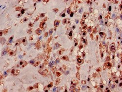 Invitrogen MRPL19 Polyclonal Antibody 100 &mu;g | Buy Online | Invitrogen&trade; | Fisher Scientific
