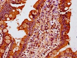 Invitrogen MTSS1 Polyclonal Antibody 100 μg; Unconjugated:Antibodies,