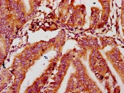 Invitrogen MTSS1 Polyclonal Antibody 100 μg; Unconjugated:Antibodies,