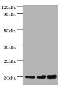 Invitrogen NAA20 Polyclonal Antibody 100 &mu;L; Unconjugated:Antibodies,