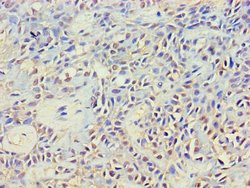 Invitrogen NCK2 Polyclonal Antibody 100 &mu;g | Buy Online | Invitrogen&trade; | Fisher Scientific