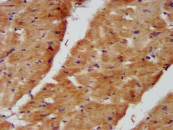 Invitrogen NDUFB8 Polyclonal Antibody 100 &mu;g; Unconjugated:Antibodies,