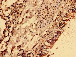 NME6 Polyclonal Antibody:Antibodies, Polyclonal