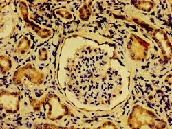 NME6 Polyclonal Antibody:Antibodies, Polyclonal