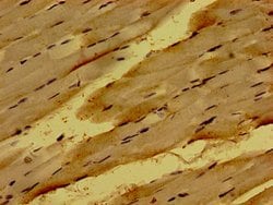 NME6 Polyclonal Antibody:Antibodies, Polyclonal
