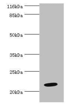 NME6 Polyclonal Antibody:Antibodies, Polyclonal